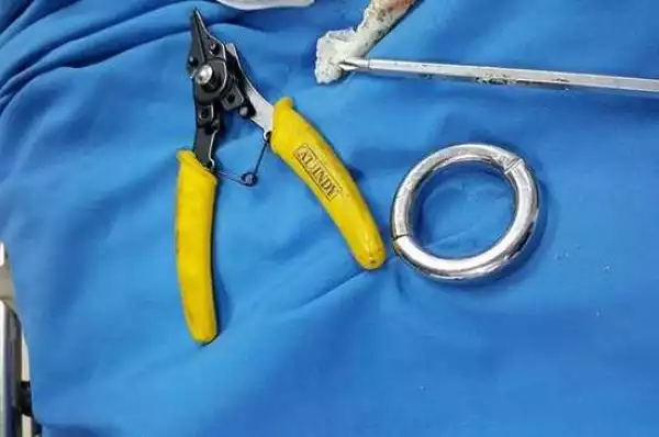 Graphic photos: Doctors use saw and bolt cutters to remove ring that got stuck on mans penis